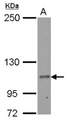 Western Blot: RIN2 Antibody [NBP2-20163]