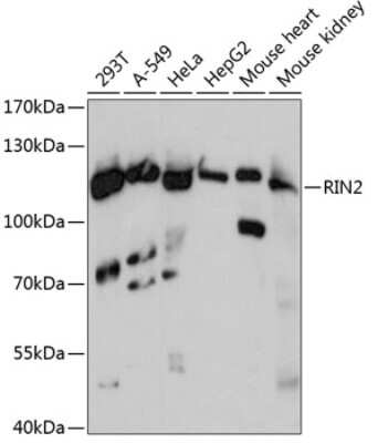 Western Blot: RIN2 AntibodyAzide and BSA Free [NBP2-94667]