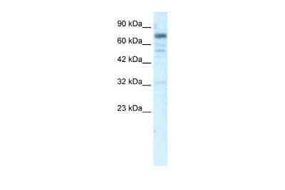 Western Blot: RIN3 Antibody [NBP2-83448]