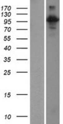 Western Blot: RIN3 Overexpression Lysate [NBP2-06260]