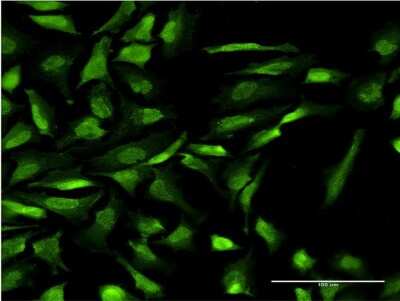 Immunocytochemistry/ Immunofluorescence: RING1 Antibody (1D5) [H00006015-M09]