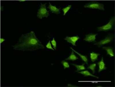 Immunocytochemistry/ Immunofluorescence: RING1 Antibody (1F4) [H00006015-M10]