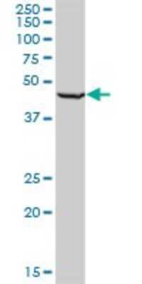 Western Blot: RING1 Antibody (2B3) [H00006015-M03]