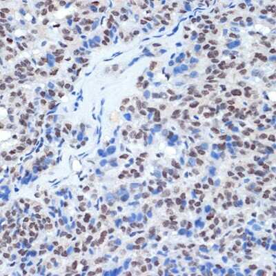 Immunohistochemistry-Paraffin: RING1 Antibody (2Q8D5) [NBP3-15893]