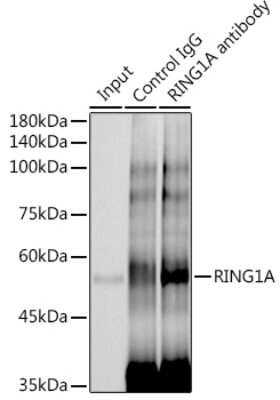 Immunoprecipitation: RING1 Antibody (2Q8D5) [NBP3-15893]