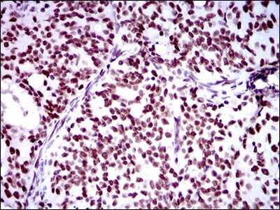 Immunohistochemistry-Paraffin: RING1 Antibody (8C12F4) - BSA Free [NBP2-37370]