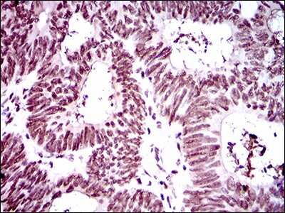 Immunohistochemistry-Paraffin: RING1 Antibody (8C12F4) - BSA Free [NBP2-37370]