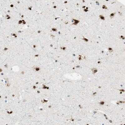 Immunohistochemistry-Paraffin: RING1 Antibody [NBP1-80830]