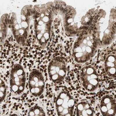 Immunohistochemistry-Paraffin: RING1 Antibody [NBP1-80830]