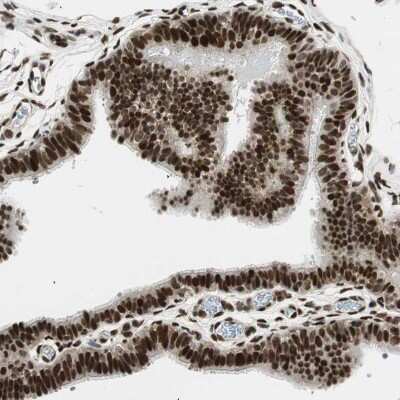 Immunohistochemistry-Paraffin: RING1 Antibody [NBP1-80830]