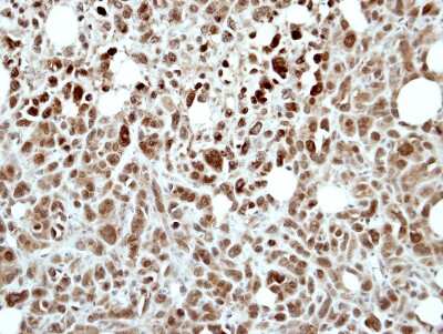 Immunohistochemistry-Paraffin: RING1 Antibody [NBP2-20164]