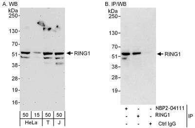 Immunoprecipitation: RING1 Antibody [NBP2-04111]