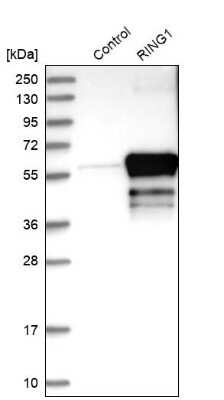 Western Blot: RING1 Antibody [NBP1-80830]