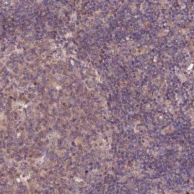 Immunohistochemistry-Paraffin: RINL Antibody [NBP1-93741]
