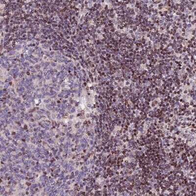 Immunohistochemistry-Paraffin: RINL Antibody [NBP1-93742]