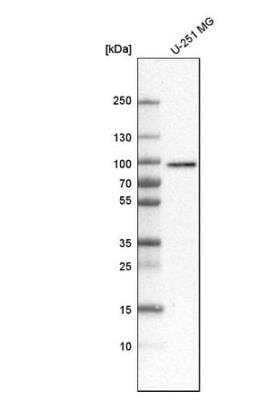 Western Blot: RINT1 Antibody [NBP1-82312]