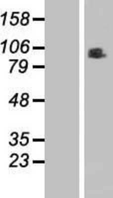 Western Blot: RINT1 Overexpression Lysate [NBL1-15373]