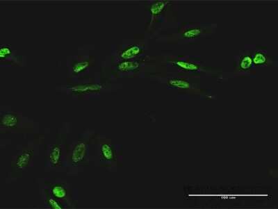 Immunocytochemistry/ Immunofluorescence: RIOK1 Antibody [H00083732-B02P]