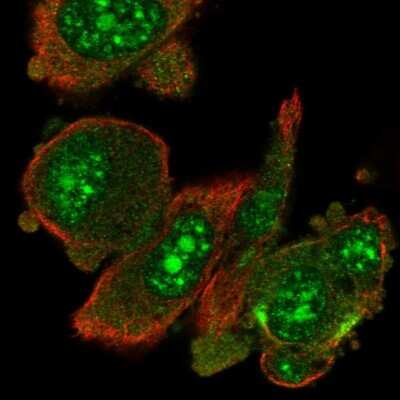 Immunocytochemistry/ Immunofluorescence: RIOK1 Antibody [NBP2-47301]