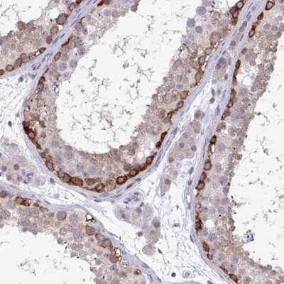 Immunohistochemistry-Paraffin: RIOK1 Antibody [NBP2-47300]