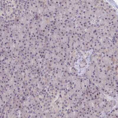 Immunohistochemistry-Paraffin: RIOK1 Antibody [NBP2-47300]