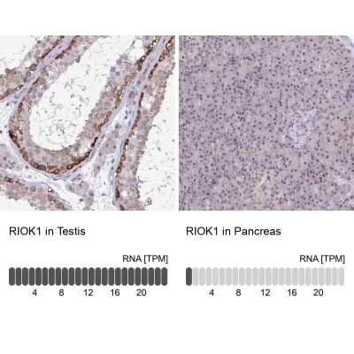 Immunohistochemistry-Paraffin: RIOK1 Antibody [NBP2-47300]