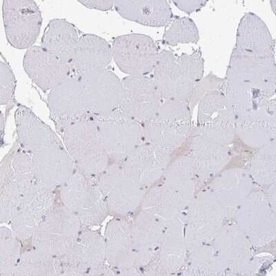 Immunohistochemistry-Paraffin: RIOK1 Antibody [NBP2-47301]