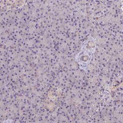 Immunohistochemistry-Paraffin: RIOK1 Antibody [NBP2-47301]