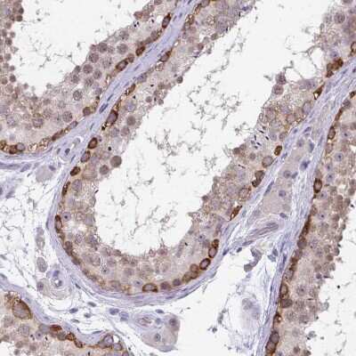 Immunohistochemistry-Paraffin: RIOK1 Antibody [NBP2-47301]