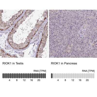 Immunohistochemistry-Paraffin: RIOK1 Antibody [NBP2-47301]