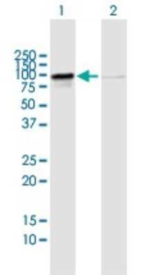 Western Blot: RIOK1 Antibody [H00083732-B02P]