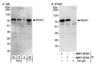 Western Blot: RIOK1 Antibody [NBP1-30103]