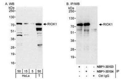 Western Blot: RIOK1 Antibody [NBP1-30104]