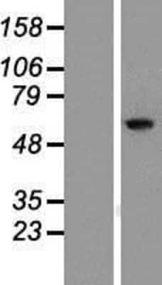 Western Blot: RIOK1 Overexpression Lysate [NBP2-09925]