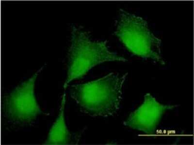 Immunocytochemistry/ Immunofluorescence: RIOK2 Antibody (1B10) [H00055781-M02]