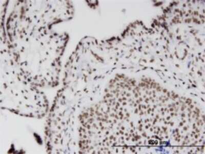 Immunohistochemistry-Paraffin: RIOK2 Antibody (1B10) [H00055781-M02]