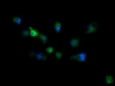 Immunocytochemistry/ Immunofluorescence: RIOK2 Antibody (OTI3E11) - Azide and BSA Free [NBP2-73910]