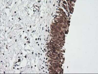 Immunohistochemistry: RIOK2 Antibody (OTI3E11) - Azide and BSA Free [NBP2-73910]