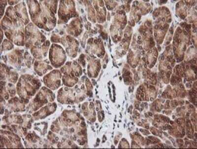 Immunohistochemistry: RIOK2 Antibody (OTI3E11) - Azide and BSA Free [NBP2-73910]
