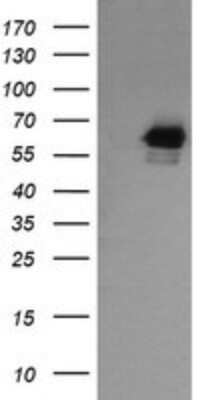 Western Blot: RIOK2 Antibody (OTI3E11)Azide and BSA Free [NBP2-73910]