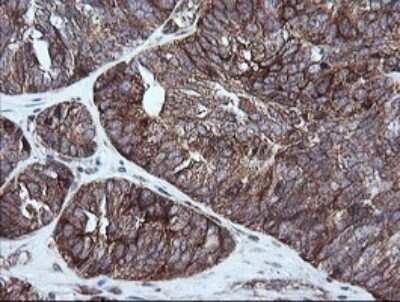 Immunohistochemistry: RIOK2 Antibody (OTI3E11) [NBP2-45960]