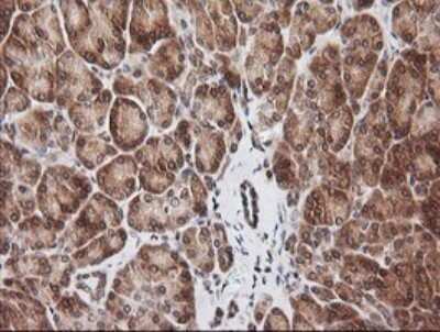 Immunohistochemistry: RIOK2 Antibody (OTI3E11) [NBP2-45960]