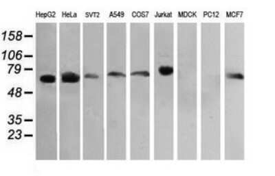 Western Blot: RIOK2 Antibody (OTI3E11) [NBP2-45960]