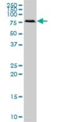 Western Blot: RIOK2 Antibody [H00055781-B01P]