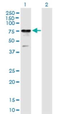 Western Blot: RIOK2 Antibody [H00055781-B01P]