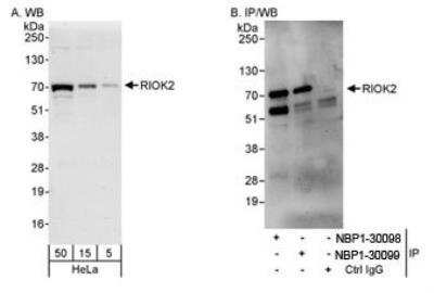 Western Blot: RIOK2 Antibody [NBP1-30098]