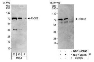 Western Blot: RIOK2 Antibody [NBP1-30099]