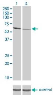 Western Blot: RIOK3 Antibody (3G11) [H00008780-M02]