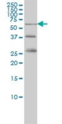 Western Blot: RIOK3 Antibody (3G11) [H00008780-M02]