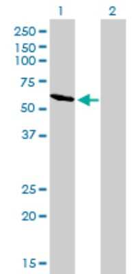 Western Blot: RIOK3 Antibody (3G11) [H00008780-M02]